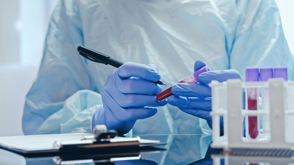 Endotoxin Testing