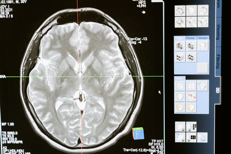 Central nervous system and neurology research